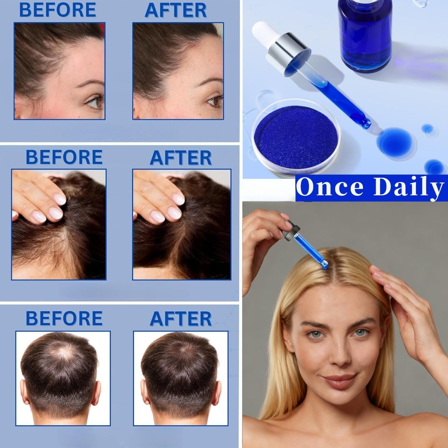 AHK-Cu Copper Peptide Scalp & Hair Care