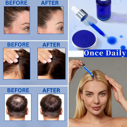 AHK-Cu Copper Peptide Scalp & Hair Care